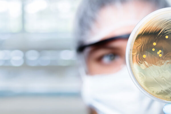 probiotics applications - probiotics by sacco system